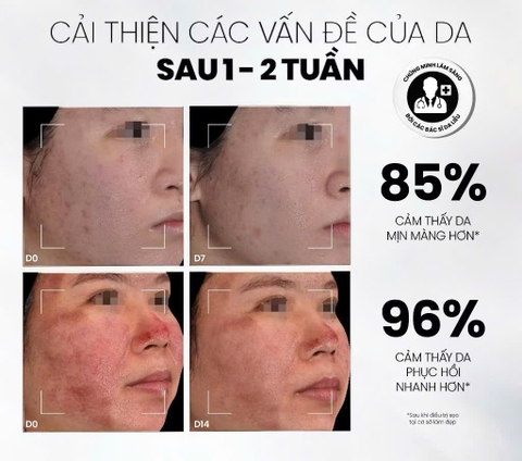 Serum Chống Lão Hóa, Kích Thích Tăng Sinh Collagen, Làm Đầy Sẹo MD CARE Copper Peptide Serum 30ml