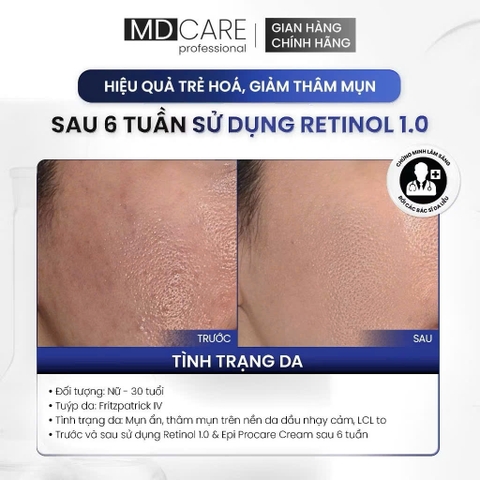 Kem Dưỡng Làm Sáng, Trẻ Hoá Và Cải Thiện Nếp Nhăn MD CARE PRO-RETINOL 30ml