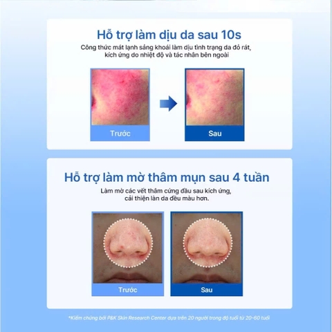 Kem dưỡng ẩm, hỗ trợ tái tạo da Midnight Blue Clearing Water Cream 50g