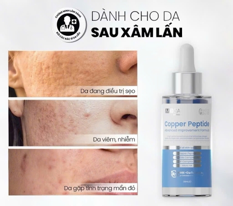 Serum Chống Lão Hóa, Kích Thích Tăng Sinh Collagen, Làm Đầy Sẹo MD CARE Copper Peptide Serum 30ml