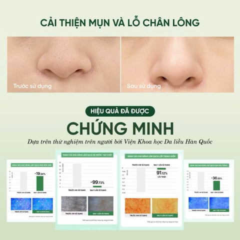Mặt Nạ Rửa Mặt 2 In 1 Làm Sạch Sâu Cho Da Dầu Mụn Nhạy Cảm Dewdap Cicatea Pore & Sebum Pack Cleanser 150ml
