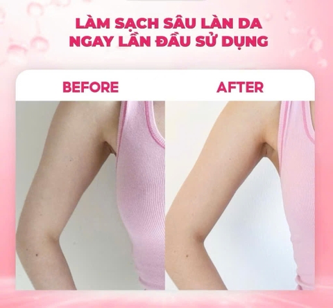 Tẩy Tế Bào Chết Body Muối Hồng Camargue Pháp Trắng Da, Mờ Thâm Sạm RMON 200g