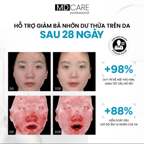 Serum Kiểm Soát Dầu Sinh Học MD CARE ZINC PHA Sebum Regulation Complex 30ml