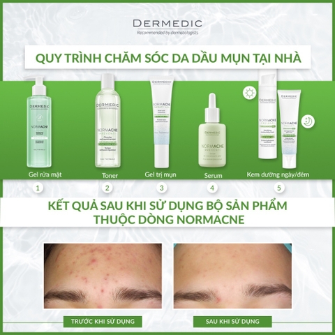 Serum kiềm dầu se khít lỗ chân lông cho da dầu Dermedic Normacne Preventi Widened Pores Serum 30ml