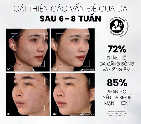 Sữa Rửa Mặt MD CARE Hydrating Milk Cleanser  Dịu Nhẹ Và Cấp Ẩm Cho Da Nhạy Cảm200ml