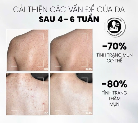 Xịt Tẩy Tế Bào Chết Toàn Thân AHAs & BHA MD CARE Exfoliating Body Spray 100ml