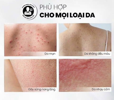 Xịt Tẩy Tế Bào Chết Toàn Thân AHAs & BHA MD CARE Exfoliating Body Spray 100ml