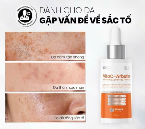Serum Sáng Da, Chống Lão Hoá MD CARE VitaC-Arbutin Serum - Whitening Advanced Formula 30ml