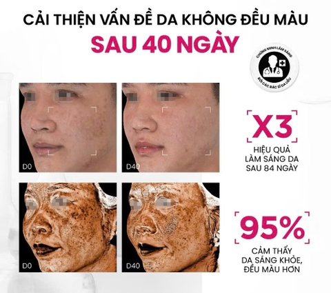 Serum Sáng Da Đa Tầng Và Toàn Diện Thế Hệ Mới MD CARE Brightenyl Serum 30ml