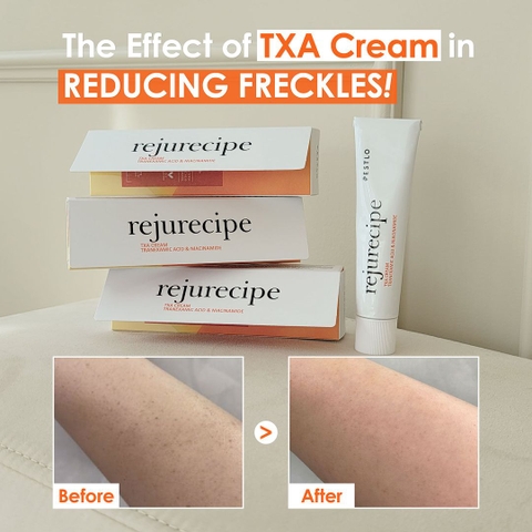 Kem dưỡng trắng PESTLO Rejurecipe TXA Cream 30ml