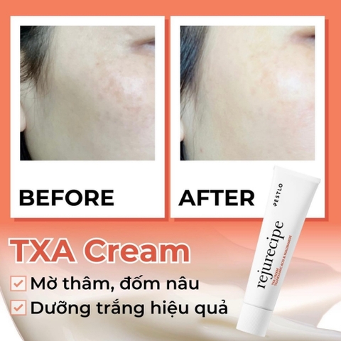 Kem dưỡng trắng PESTLO Rejurecipe TXA Cream 30ml
