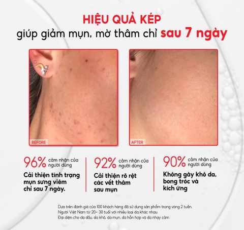 Tinh Chất Giảm Mụn, Mờ Thâm, Làm Sạch Tế Bào Chết 12% PHA + 4,75% Tiam AC Fighting PHA 12 Purifying Liquid