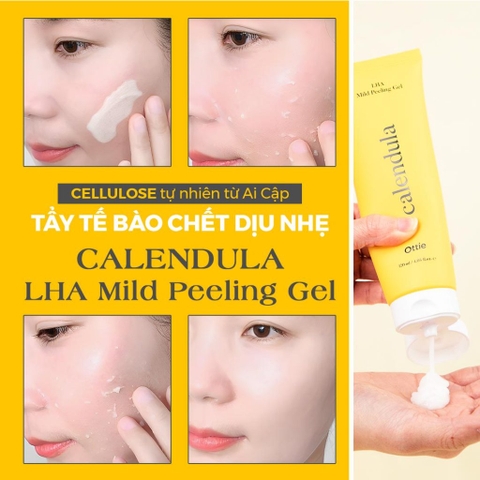 Tẩy Tế Bào Chết LHA Ottie Calendula LHA Mild Peeling Gel Tẩy Tế Bào Chết Ottie Hoa Cúc Dịu Nhẹ 120ml