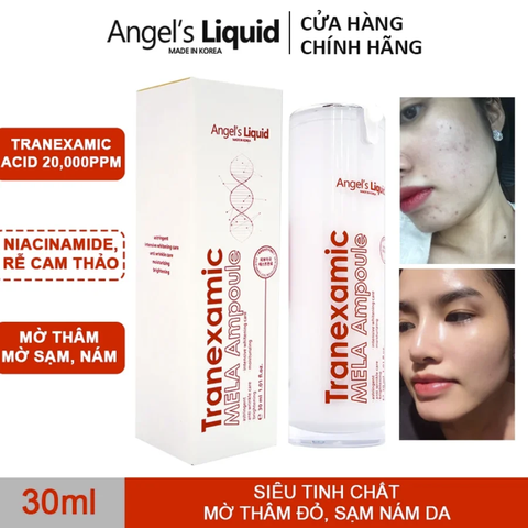 Tinh Chất Mờ Nám Chuyên Sâu Angel's Liquid Tranexamic Mela Ampoule 30ml (Trắng)