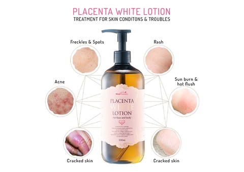 Dược Mỹ Phẩm Dưỡng Trắng Da Toàn Thân từ nhau thai Placenta White Lotion Nhật Bản