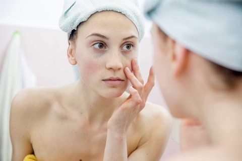 Bật mí 5 cách trị sẹo thâm sau khi tẩy nốt ruồi hiệu quả ngay tại nhà