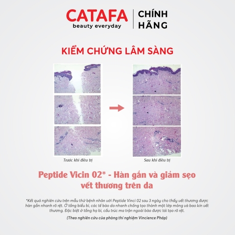 J19 Kem dưỡng ẩm, làm dịu và giảm khô da Dermal Age Defy (Light) - Jean d'Arcel