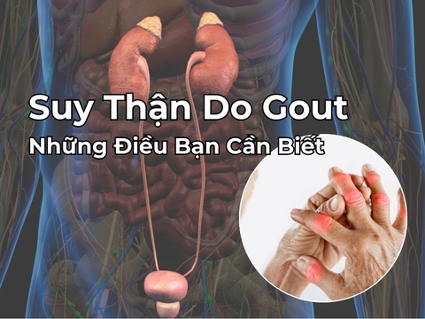 Suy Thận Do Gout - Những Điều Bạn Cần Biết