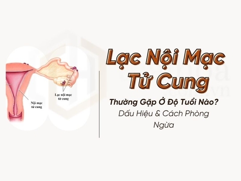 Lạc Nội Mạc Tử Cung Thường Gặp Ở Độ Tuổi Nào? Dấu Hiệu & Cách Phòng Ngừa