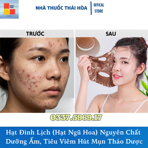 Hạt Đình Lịch (Hạt Ngũ Hoa) Nguyên Chất - Giải Pháp Tiêu Viêm, Hút Mụn Thảo Dược Tại Nhà