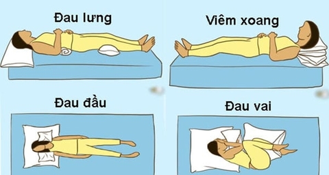 Các tư thế ngủ giúp ngủ ngon, phục hồi sức khỏe