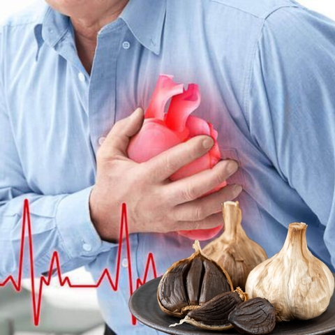 LỢI ÍCH CỦA TỎI ĐEN CHO NGƯỜI BỆNH TIM MẠCH