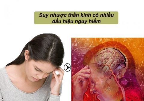 CÁC DẤU HIỆU CỦA SUY NHƯỢC THẦN KINH MÀ BẠN CẦN LƯU Ý