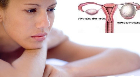 TỔNG HỢP MỘT SỐ BỆNH VIÊM NHIỄM PHỤ KHOA NGUY HẠI NHẤT