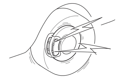 Tìm hiểu về "cảm biến báo mòn phanh"