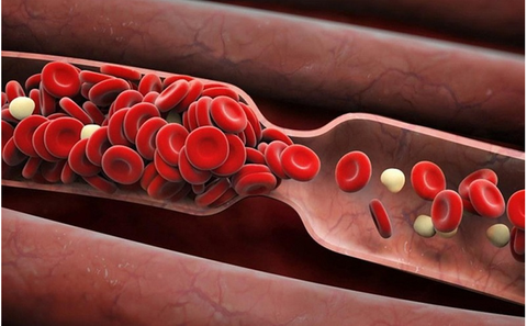 Xét nghiệm cardiolipin xác định nguyên nhân sảy thai nhiều lần ở phụ nữ