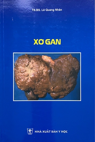 Xơ gan