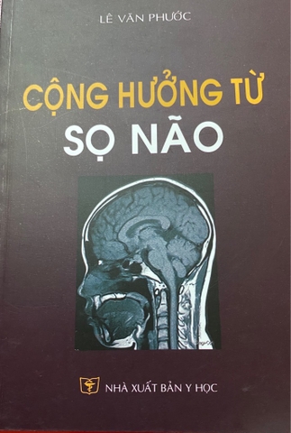 Cộng hưởng từ Sọ não