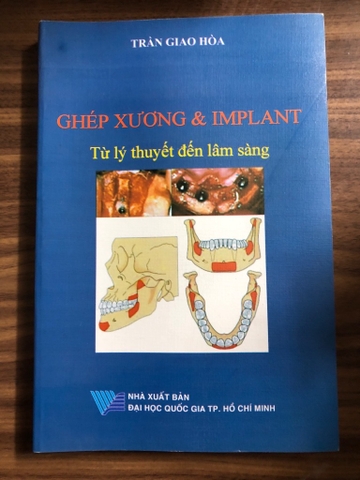 Ghép xương và Impant từ lý thuyết đến lâm sàng