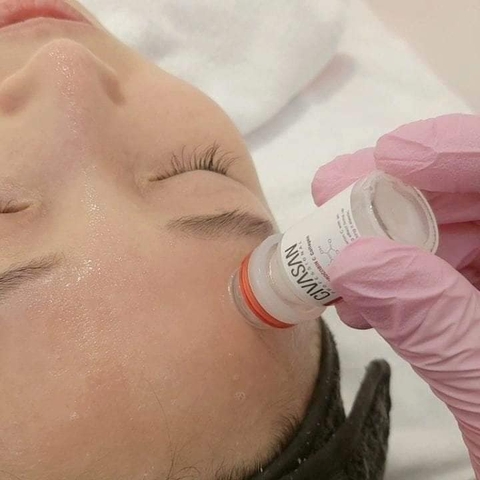 Microneedling - Cấy tinh chất trắng da Varocobin C