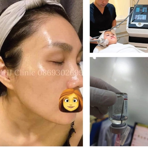 TIGHTENING & GLOW SKIN | Săn chắc lỗ chân lông và căng bóng da