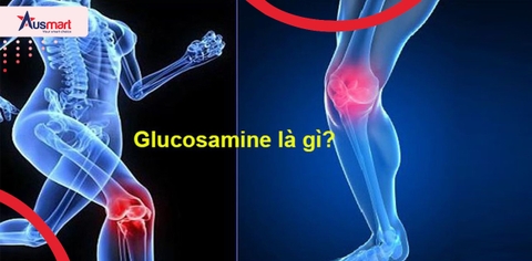 Glucosamine Là Gì? Top 5 TPCN Glusamine Của Úc