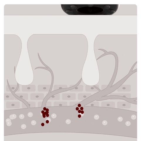 Máy cạo và giác hơi thông minh Xiaomi LERAVAN RSW-328