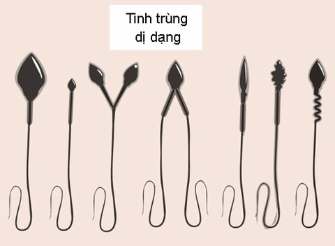 Tinh trùng dị dạng nhiều, kém di động có dùng được Long Phụ Đan không?