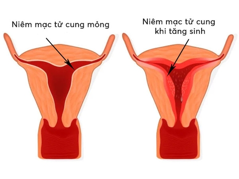 Niêm mạc tử cung mỏng có thai được không?