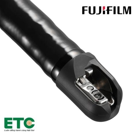 Ống nội soi tá tràng nghiêng (ERCP) 