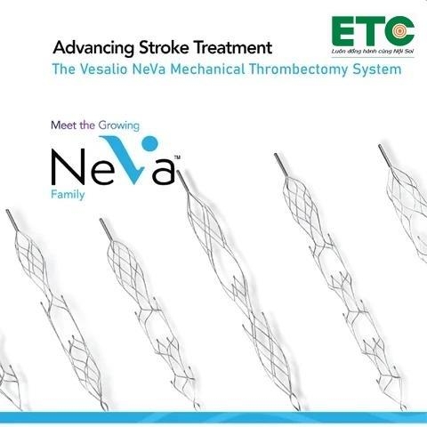 Stent lấy khối huyết mạch máu não NEVA