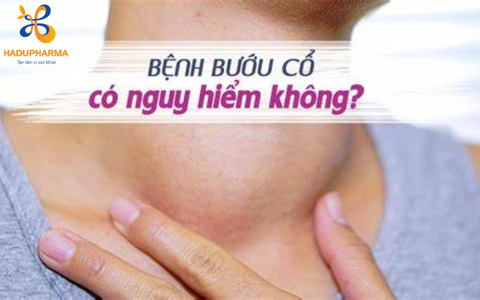GIẢI MÃ BỆNH BƯỚU CỔ: NGUYÊN NHÂN, TRIỆU CHỨNG, CÁCH PHÒNG NGỪA