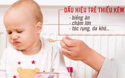 DẤU HIỆU NHẬN BIẾT TRẺ THIẾU KẼM