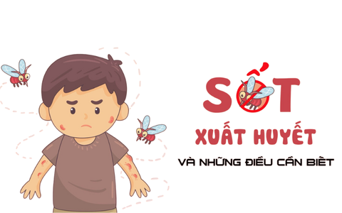 CẢNH BÁO SỐT XUẤT HUYẾT ĐANG BÙNG PHÁT, ĐỪNG NHẦM LẪN VỚI CÁC BỆNH SỐT THÔNG THƯỜNG