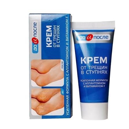 Kem Trị Nứt Gót Chân Kpem Nga 50ml