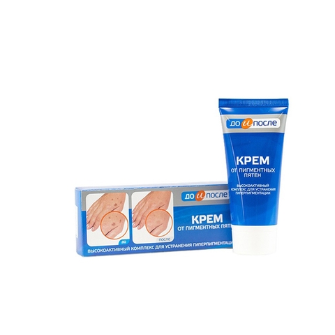 Kem Trị Đồi Mồi Tay Kpem Nga 50ml