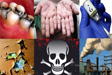 Tiến Sĩ Mỹ Josh Axe chỉ rõ 6 dấu hiệu cơ thể nhiễm độc kim loại nặng !!!