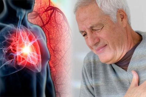 PECTIN COMPLEX GIÚP PHÒNG NGỪA CÁC BỆNH KHÔNG LÂY NHIỄM