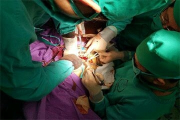 Uống 5 thìa thuốc cam, trẻ bị viêm loét họng phải cấp cứu