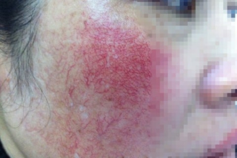 Những hóa chất độc hại chứa trong mỹ phẩm mà bạn không biết